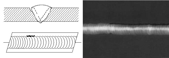 Undercut Radiograph Radiographic Testing of Welds - Sawyer Mfg. Company